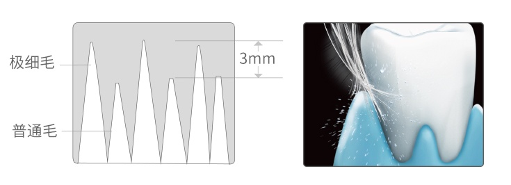 看完这篇电动牙刷功能介绍，你就不会迷惑了